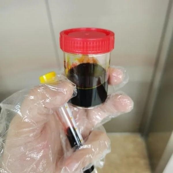 急性肝衰竭！兩兄弟誤吃這種菌 專家提醒